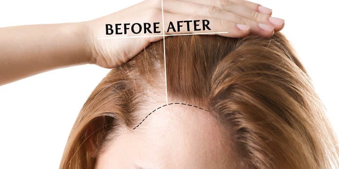 Bizarre Ways To Stimulate Hair Growth – YouBeauty